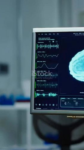 Understanding Dopamine Beyond the 'Feel'