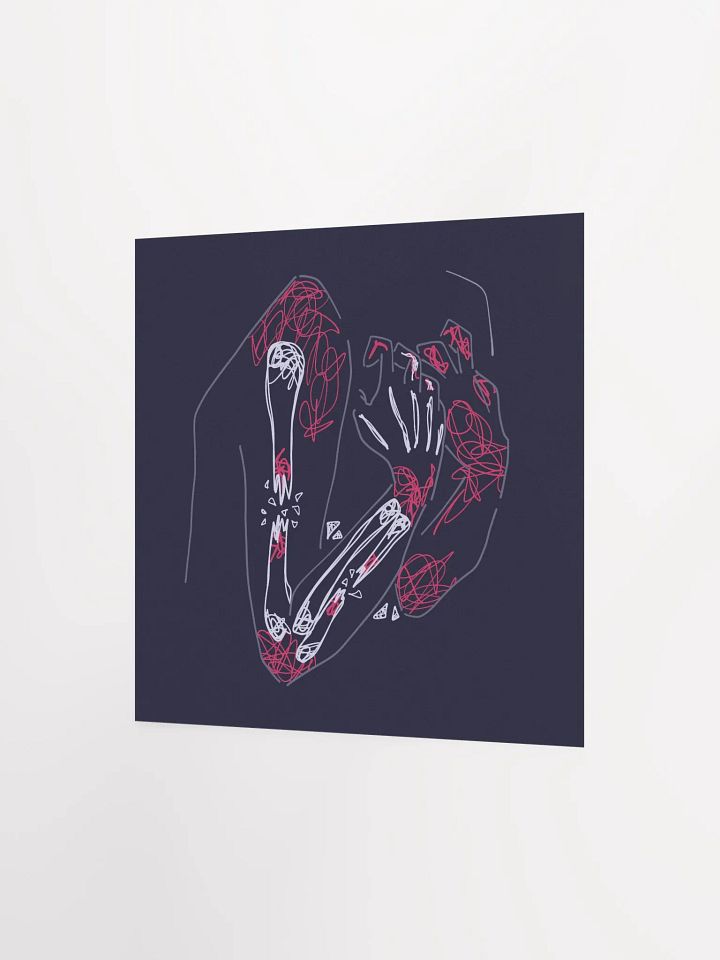 Chronic Pain - Print product image (8)