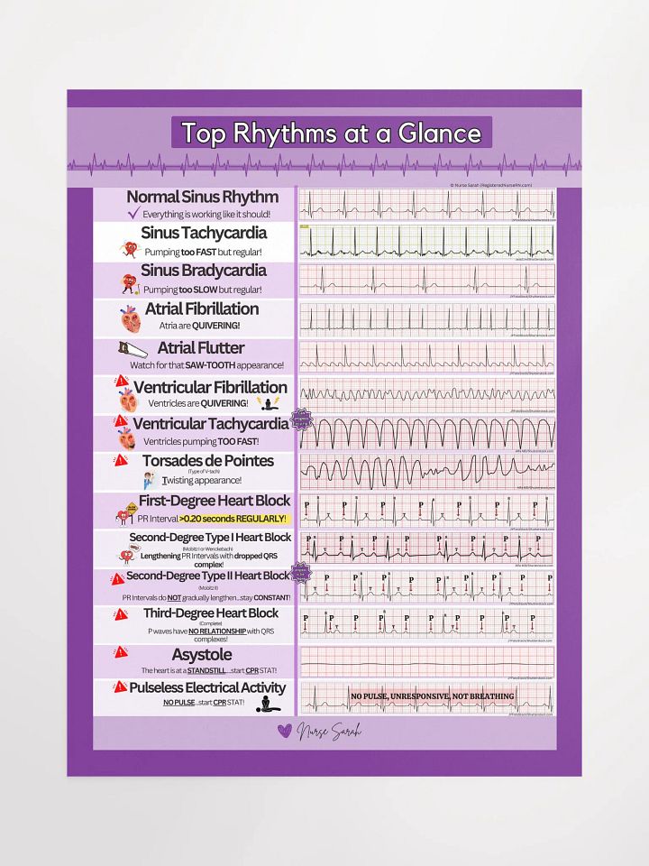 ECG/EKG Rhythms at a Glance Wall Poster by Nurse Sarah product image (1)