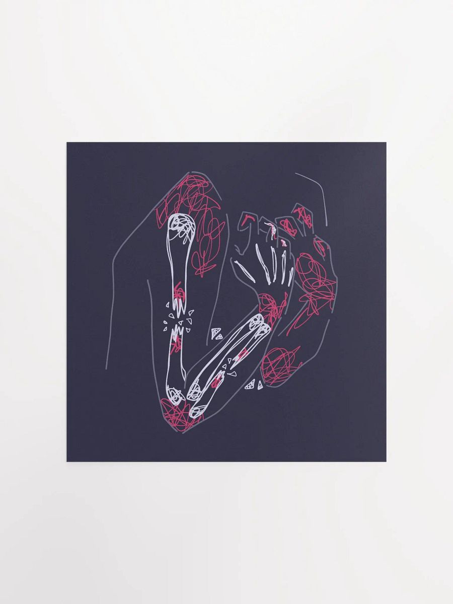Chronic Pain - Print product image (3)