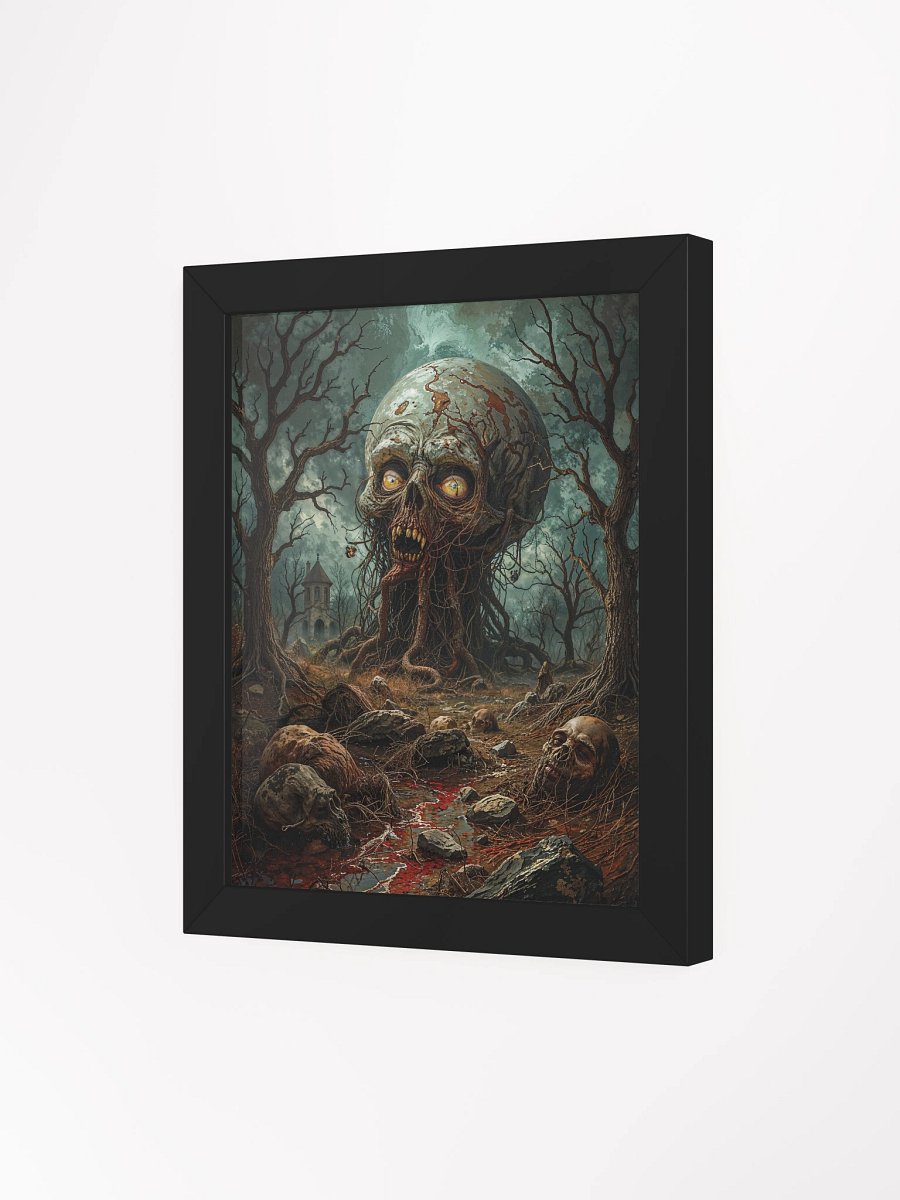 The Skull That Ate the Forest Framed Print product image (19)