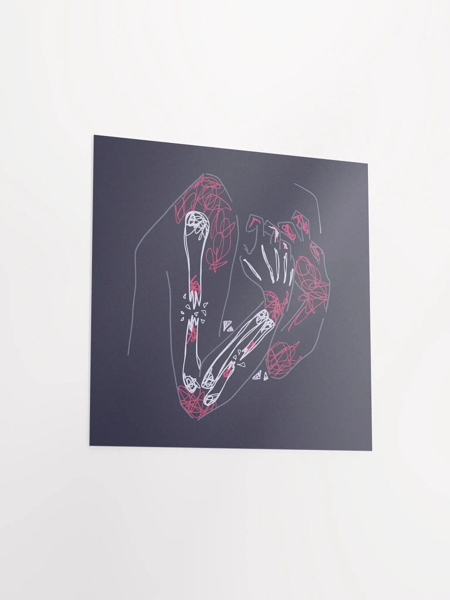 Chronic Pain - Print product image (12)