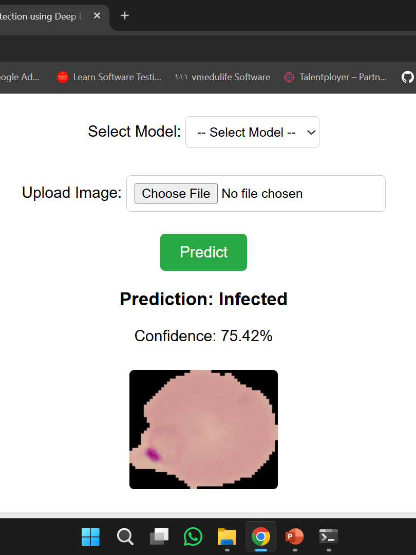 Malaria Disease Prediction System using Deep Learning with Flask App Project product image (12)