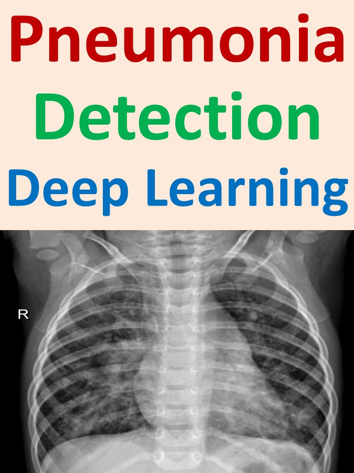 Pneumonia Detection from Chest X-Ray with Flask App Deep Learning Project product image (1)