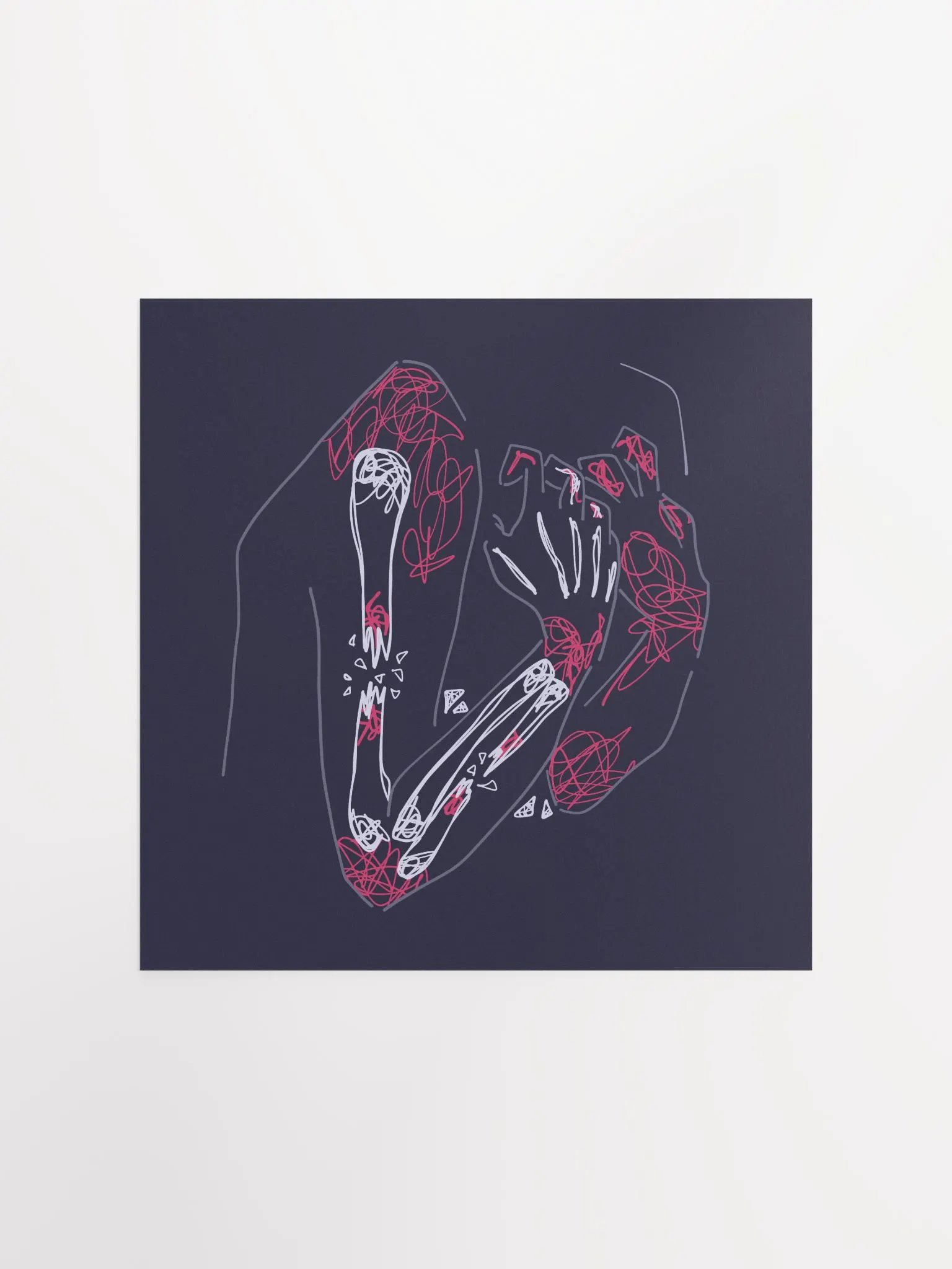 Chronic Pain - Print product image (3)