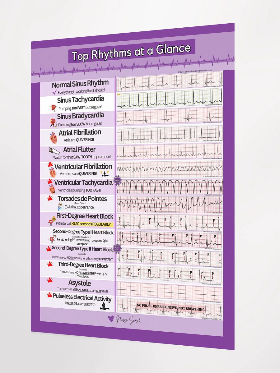 ECG/EKG Rhythms at a Glance Wall Poster by Nurse Sarah product image (2)