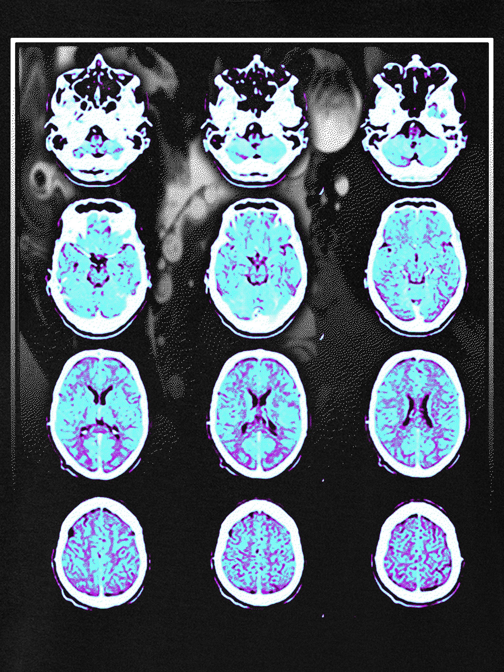 MIGRAINE Shirt product image (5)