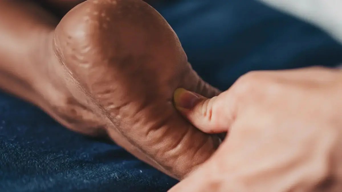 An anatomical diagram of the foot skeleton highlighting the plantar fascia ligament. The image shows the most common location of plantar fasciitis as a red, inflamed area right at the base of the heel, indicating heel pain where the fascia attaches to the calcaneus bone.