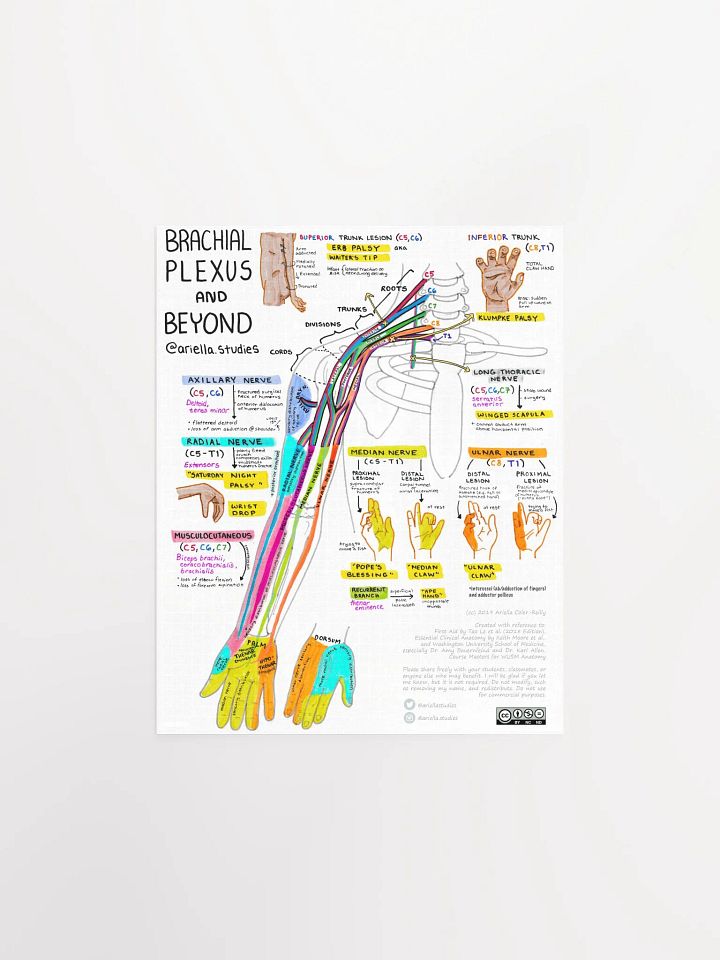 Brachial Plexus Poster product image (1)