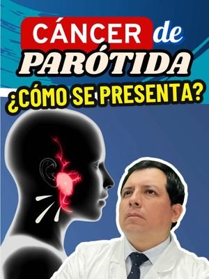 🩺 Cáncer de Glándulas Salivales: Parótida – Síntomas y Manejo 💡 El cáncer de glándulas salivales es un tipo raro de cáncer que se origina en las glándulas salivales, las cuales producen saliva para facilitar la digestión y mantener la boca húmeda. Las glándulas parótidas son las glándulas salivales más grandes, ubicadas cerca de las orejas, y son las más comúnmente afectadas por el cáncer en esta área. Aunque el cáncer de glándulas salivales es poco frecuente, es importante reconocer sus síntomas y recibir un tratamiento adecuado a tiempo. Aquí te explicamos los síntomas y el manejo de este tipo de cáncer. 🔹 Síntomas Comunes 🚨 Bulto en la zona de la mandíbula o cuello 💥 El síntoma más común de cáncer en las glándulas parótidas es la aparición de un bulto o masa cerca de la mandíbula, debajo de la oreja o en el cuello. Este bulto puede ser indoloro al principio, pero con el tiempo puede volverse doloroso. Dolor en la zona afectada 😖 Aunque el bulto inicial puede no causar dolor, a medida que el tumor crece, puede provocar dolor en la zona de la glándula afectada, especialmente si presiona nervios o tejidos cercanos. Entumecimiento o debilidad en la cara 😶 El cáncer de glándulas salivales, especialmente en la parótida, puede afectar los nervios faciales, lo que puede causar entumecimiento, debilidad o dificultad para mover una parte de la cara (parálisis facial). Sequedad en la boca o dificultad para tragar 💦 Los tumores en las glándulas salivales pueden afectar la producción de saliva, lo que causa sequedad en la boca y dificultad para tragar. Sangrado en la boca o dolor de garganta 🤢 En algunos casos, el tumor puede provocar sangrado en la boca o dolor al tragar debido a la irritación de los tejidos cercanos. 🔹 Manejo del Cáncer de Glándulas Salivales Parótidas 🏥 El tratamiento del cáncer de glándulas salivales depende del tipo y estadio del tumor. Las opciones incluyen: Cirugía 🏥 La extirpación quirúrgica del tumor es el tratamiento principal para el cáncer de glándulas salivales. Si el tumor está limitado a una glándula, el cirujano puede extirpar la glándula afectada (parotidectomía). En algunos casos, también pueden extirparse los ganglios linfáticos cercanos si se ha producido metástasis. Radioterapia ⚡ La radioterapia se utiliza a menudo después de la cirugía para destruir cualquier célula cancerosa restante, especialmente si el cáncer es agresivo o ha afectado más de una glándula. Quimioterapia 💊 En casos de cáncer avanzado o cuando el tumor no puede extirparse completamente, la quimioterapia puede ser utilizada para reducir el tamaño del tumor y eliminar células cancerosas. Terapia dirigida 🧬 En algunos casos, los medicamentos de terapia dirigida pueden ser útiles para atacar específicamente las células cancerosas, reduciendo los efectos secundarios sobre las células sanas. 🥗 Consejo: Si experimentas un bulto persistente en la zona de la mandíbula o cuello, dificultad para tragar o cambios en la cara, consulta a un médico para un diagnóstico temprano. El tratamiento adecuado mejora las posibilidades de recuperación y la calidad de vida. #CáncerDeGlándulasSalivales #CáncerDeParótida #SaludOral #Bienestar #CuidadoDeLaSalud #Prevención #dr_luispacora #luispacoracamargo #LIVEIncentiveProgram #LIVEwithlowfollowers #PaidPartnership 