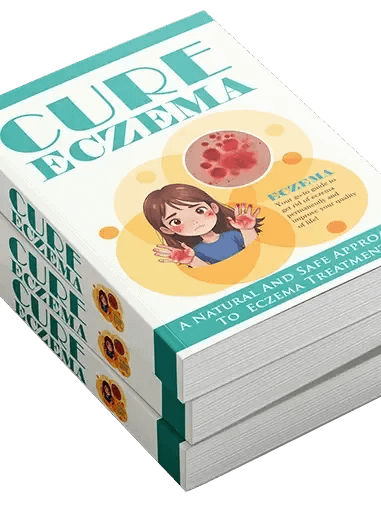 Cure Eczema digital guide product image (2)