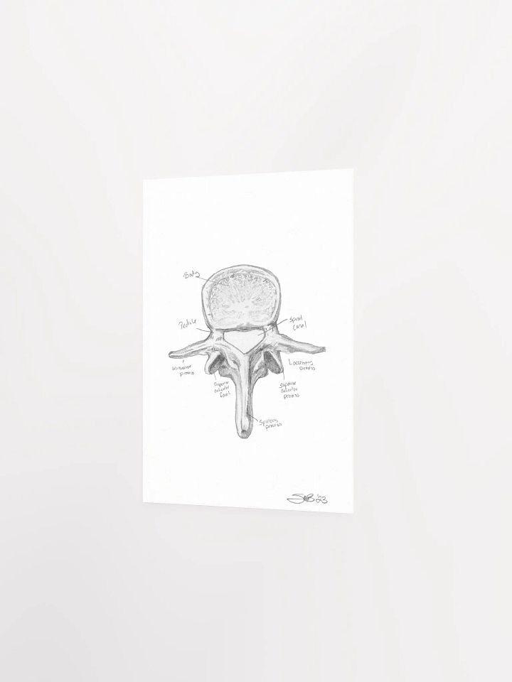 Lumbar Vertebrae Wall Art (Labeled) product image (3)