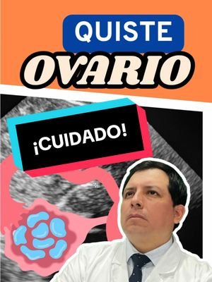 🩺 Cáncer de Vesícula: Síntomas y Factores de Riesgo 🍽️ El cáncer de vesícula biliar es un tipo de cáncer poco frecuente pero grave que se origina en la vesícula biliar, un pequeño órgano ubicado debajo del hígado que almacena la bilis. Aunque este tipo de cáncer es difícil de detectar en sus primeras etapas, conocer sus síntomas y factores de riesgo puede ayudar a la detección temprana y mejorar las posibilidades de tratamiento. Aquí te contamos todo lo que necesitas saber sobre esta enfermedad: 🔹 Síntomas Comunes 🔍 Dolor en la parte superior derecha del abdomen 💥 El dolor abdominal en el área donde se encuentra la vesícula biliar es uno de los síntomas más comunes del cáncer de vesícula. Este dolor puede ser constante o intermitente y puede irradiar hacia la espalda. Náuseas y vómitos 🤢 Las personas con cáncer de vesícula pueden experimentar náuseas y vómitos inexplicables, que a menudo empeoran después de comer. Ictericia 🌿 La ictericia es una coloración amarillenta de la piel y los ojos que ocurre cuando los conductos biliares están bloqueados, lo que impide que la bilis fluya correctamente. Esto puede ser un signo de que el cáncer ha afectado los conductos biliares. Pérdida de peso inexplicada ⚖️ La pérdida de peso sin explicación es otro síntoma común, ya que el cáncer afecta el apetito y el metabolismo. Hinchazón o sensación de plenitud 🍽️ La hinchazón del abdomen o una sensación de plenitud después de comer pequeñas cantidades de alimentos puede ser una señal de que algo no está funcionando correctamente en el sistema digestivo. 🔹 Factores de Riesgo ⚠️ Edad y género ⏳ El cáncer de vesícula es más común en personas mayores de 60 años y afecta con mayor frecuencia a las mujeres que a los hombres. Cálculos biliares 💎 Las personas con cálculos biliares tienen un mayor riesgo de desarrollar cáncer de vesícula, ya que estos pueden irritar la vesícula biliar y aumentar la probabilidad de cáncer. Obesidad 🏋️‍♀️ La obesidad está asociada con un mayor riesgo de desarrollar cáncer de vesícula, ya que afecta la producción de bilis y puede contribuir a la formación de cálculos biliares. Enfermedades inflamatorias crónicas 🩺 Condiciones como la colecistitis crónica (inflamación de la vesícula biliar) aumentan el riesgo de cáncer de vesícula. Historia familiar de cáncer 🧬 Si tienes antecedentes familiares de cáncer de vesícula o cáncer en general, tu riesgo puede ser mayor. 🥗 Consejo: Si experimentas síntomas persistentes o si estás en un grupo de riesgo, es fundamental consultar a un médico para obtener un diagnóstico adecuado. Un tratamiento temprano puede mejorar significativamente las posibilidades de éxito. #CáncerDeVesícula #SaludDigestiva #CuidadoDeLaSalud #Bienestar #Prevención #luispacora #CapCut #luispacoracamargo #dr_luispacora  #LIVEIncentiveProgram #LIVERewards #PaidPartnership 