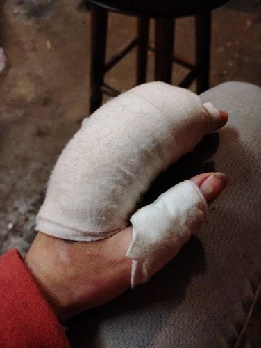 Atleast it wasn't my drawing hand