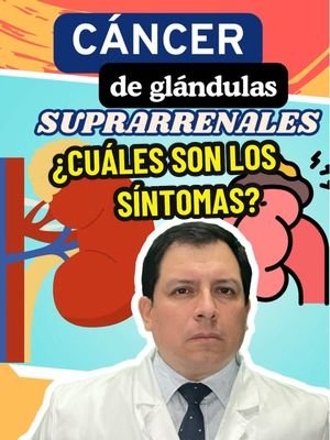 🩺 Cáncer de Glándulas Suprarrenales: Síntomas y Manejo 🧠 Las glándulas suprarrenales son dos pequeñas glándulas situadas sobre cada riñón. Estas glándulas son responsables de producir hormonas esenciales como adrenalina, cortisol y aldosterona, que regulan funciones clave como la respuesta al estrés, el equilibrio de líquidos y la presión arterial. El cáncer de glándulas suprarrenales, aunque poco frecuente, puede desarrollarse en una o ambas glándulas y afectar la producción de hormonas. Los tumores en estas glándulas pueden ser benignos o malignos (cáncer), siendo estos últimos más raros. Aquí te explicamos los síntomas y las opciones de manejo para el cáncer de glándulas suprarrenales. 🔹 Síntomas Comunes 🚨 Dolor abdominal o en la parte baja de la espalda 💥 El dolor persistente en el área del abdomen o en la parte baja de la espalda es uno de los síntomas más comunes, ya que el tumor presiona los órganos cercanos. Cambios hormonales 🧠 El cáncer de las glándulas suprarrenales puede alterar la producción de hormonas, lo que lleva a síntomas como: Aumento de peso inexplicable (debido al exceso de cortisol). Aumento de la presión arterial debido a la sobreproducción de aldosterona. Cambios en la piel como acné o vello facial excesivo, especialmente en mujeres, debido a la sobreproducción de hormonas masculinas (andrógenos). Fatiga y debilidad 😴 La producción alterada de cortisol puede causar fatiga extrema y una sensación general de debilidad. Sudoración excesiva y ansiedad 💦 El aumento de adrenalina (producción descontrolada de catecolaminas) puede generar sudoración excesiva, nerviosismo y ansiedad. Pérdida de peso inexplicada ⚖️ La pérdida de peso, a menudo acompañada de pérdida de apetito, puede ser un signo de cáncer que afecta el metabolismo. 🔹 Manejo del Cáncer de Glándulas Suprarrenales 🏥 El tratamiento del cáncer de glándulas suprarrenales depende de su tipo, tamaño, y si se ha diseminado a otras áreas. Las opciones incluyen: Cirugía 🏥 La extirpación quirúrgica de la glándula suprarrenal afectada es el tratamiento principal. Si el tumor es maligno, se realiza una adrenalectomía, que es la extirpación completa de la glándula. Radioterapia ⚡ La radioterapia puede ser utilizada después de la cirugía, especialmente si el cáncer se ha diseminado, para eliminar cualquier célula cancerosa restante. Quimioterapia 💊 La quimioterapia se puede utilizar en casos de cáncer avanzado, donde el tumor se ha diseminado más allá de las glándulas suprarrenales. Tratamiento hormonal 💉 Cuando el tumor afecta la producción hormonal, el tratamiento de sustitución hormonal puede ser necesario para restaurar los niveles adecuados de hormonas en el cuerpo. 🥗 Consejo: Si experimentas síntomas como dolor abdominal, cambios en la piel, o fatiga persistente, es fundamental buscar atención médica. Un diagnóstico temprano y un tratamiento adecuado son clave para un manejo exitoso del cáncer de glándulas suprarrenales. #CáncerDeGlándulasSuprarrenales #SaludEndocrina #CuidadoDeLaSalud #Bienestar #Prevención #dr_luispacora #luispacoracamargo #LIVEIncentiveProgram #MyLIVEJourney #PaidPartnership 