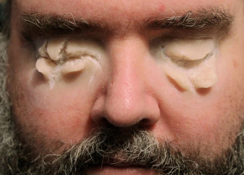 Jess FX - Appliance - Silicone Gouged Out Eyes Prosthetic product image (3)