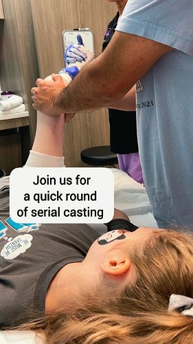 Round one - serial casting into flexion at the @paleyinstitute #arthrogryposis #teamamcana