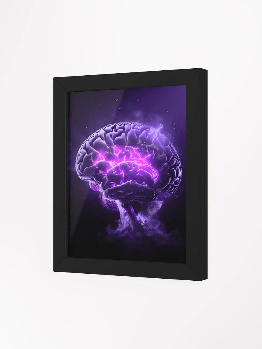 Remyelinating Brain (Framed Matte Print) product image (3)