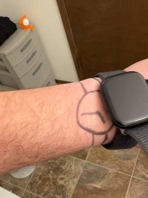 What is wrong with my wrist bro #comedy #funny #tanlines #aberdeen 