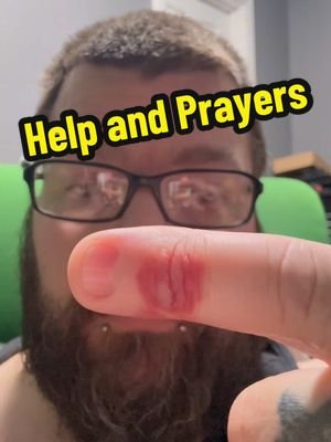Update from last video… please send some prayers if you pray because I have no idea what’s wrong with me  #foryoupage #fyp #gout #prayer #help 