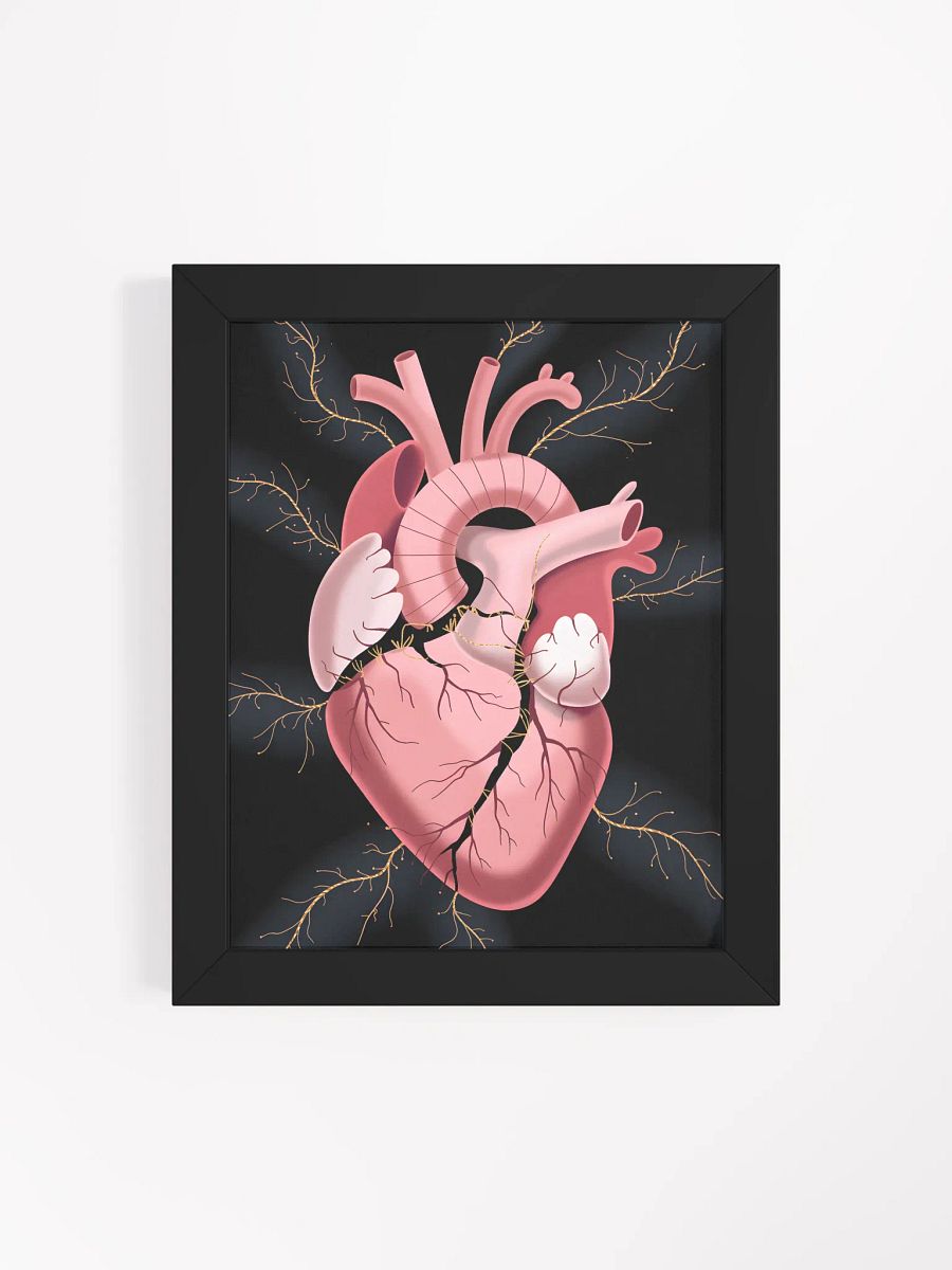 Cracked Heart Gold Veins Art | Emotional Support Symbolism Print product image (4)