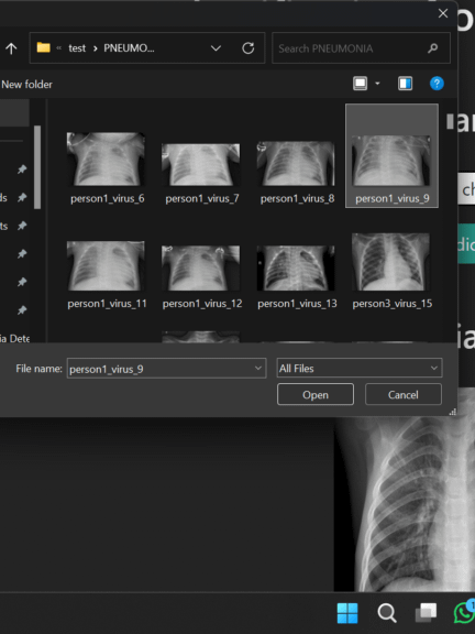 Pneumonia Detection from Chest X-Ray with Flask App Deep Learning Project product image (9)