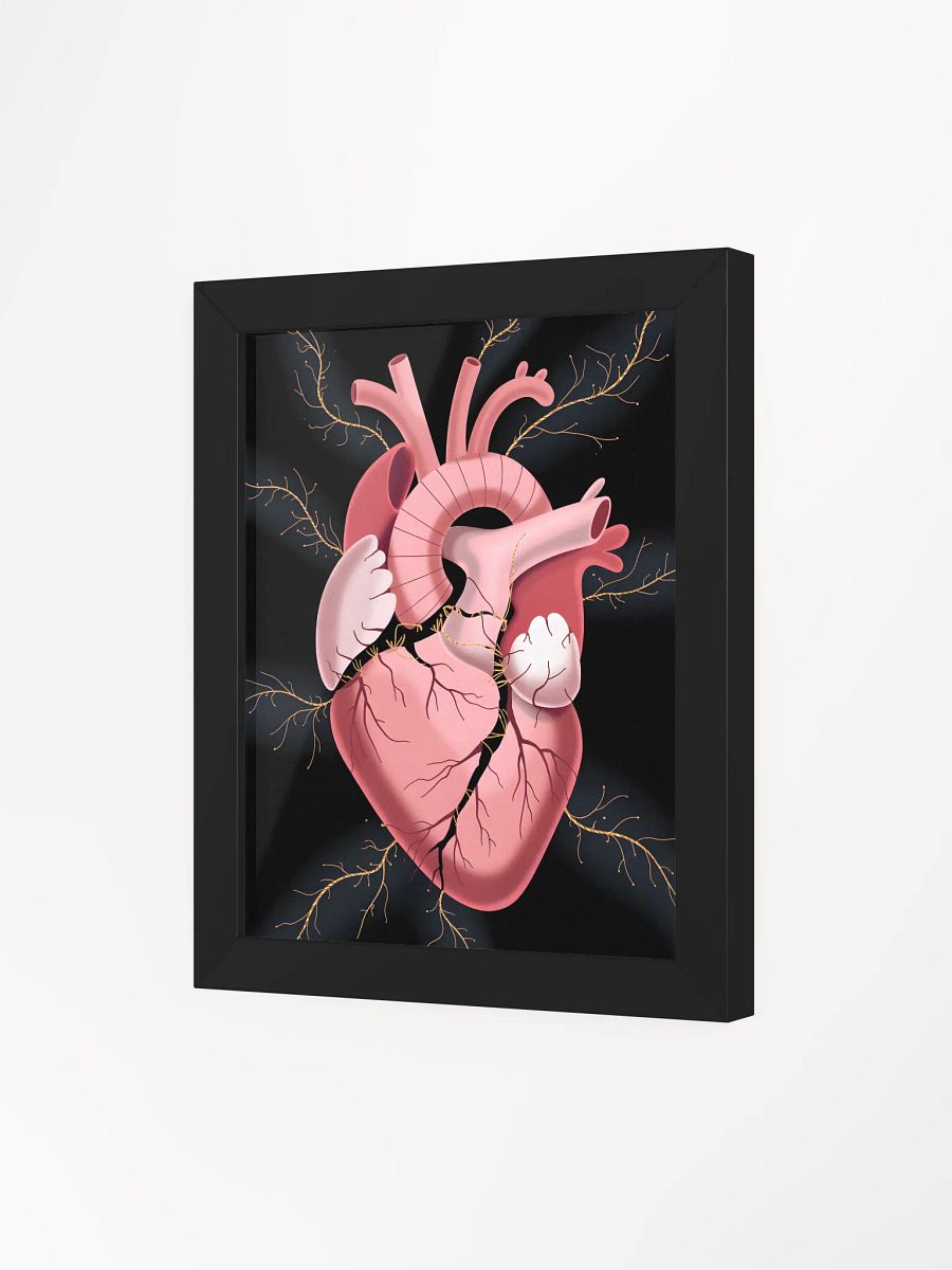 Cracked Heart Gold Veins Art | Emotional Support Symbolism Print product image (3)