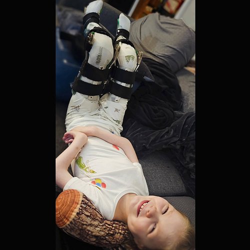 #somethingtothinkabout - Ana goes to bed almost every night with her legs forced into an 105° angle (flexion) for an hour and...