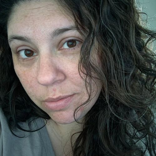 My little grey hairs are cute. Fight me.