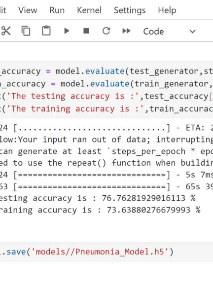 Pneumonia Detection from Chest X-Ray with Flask App Deep Learning Project product image (2)