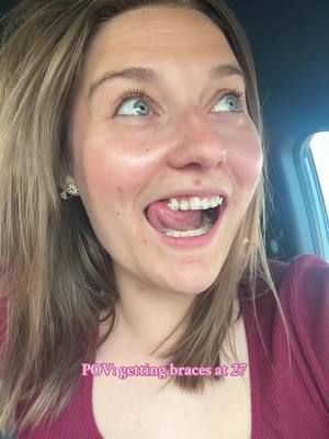 Welp.. this is gonna be a wild ride🤭 #cozygamingcommunity #twitchstreamer #braces #bracesjourney #vlod #cozygamer 
