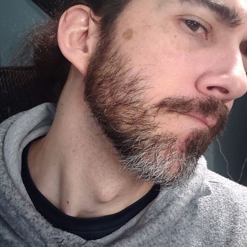 It's getting kind of wild on my face.

I definitely overdid it with No Shave November.