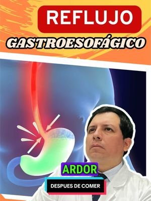 🍽️ Reflujo Gastroesofágico: ¿Qué Es y Cuáles Son Sus Síntomas? 🩺 El reflujo gastroesofágico (RGE) es una afección digestiva común que ocurre cuando el ácido gástrico del estómago fluye hacia el esófago, el tubo que conecta la boca con el estómago. Este flujo de ácido puede irritar el revestimiento del esófago, causando una variedad de síntomas. Si bien es normal que el ácido suba al esófago ocasionalmente (por ejemplo, después de comer en exceso), cuando esto sucede con frecuencia, puede ser indicativo de enfermedad por reflujo gastroesofágico (ERGE), que requiere tratamiento para evitar complicaciones graves. Aquí te explicamos los síntomas más comunes del reflujo gastroesofágico: 🔹 1. Acidez estomacal (pirosis) 🔥 El síntoma más característico del reflujo es una sensación de ardor en el pecho o en la parte superior del abdomen, conocida como acidez estomacal. Esta sensación suele empeorar después de comer, cuando te agachas o cuando te acuestas. 🔹 2. Regurgitación ácida 🤢 La regurgitación ácida es el sabor amargo o ácido que sube hacia la boca. A menudo ocurre cuando te agachas o te acuestas, ya que el ácido del estómago fluye hacia el esófago y la garganta. 🔹 3. Dificultad para tragar 🥴 Las personas con RGE a menudo sienten que los alimentos o líquidos se atascan o no pasan bien al tragar, lo que se conoce como disfagia. 🔹 4. Tos persistente o dolor de garganta 🤧 El reflujo ácido puede irritar la garganta y las cuerdas vocales, lo que puede causar tos crónica, garganta irritada, o una sensación de que hay algo 