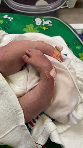 Today we’re celebrating Harrison’s incredible clubfoot journey from tiny casts to unstoppable steps. What once felt overwhelm...