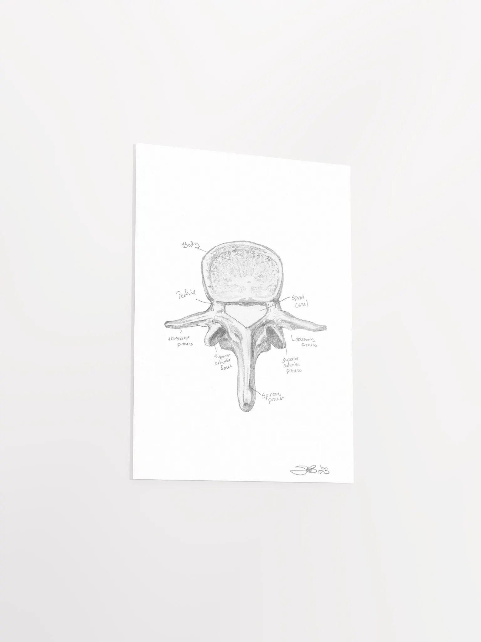 Lumbar Vertebrae Wall Art (Labeled) product image (5)