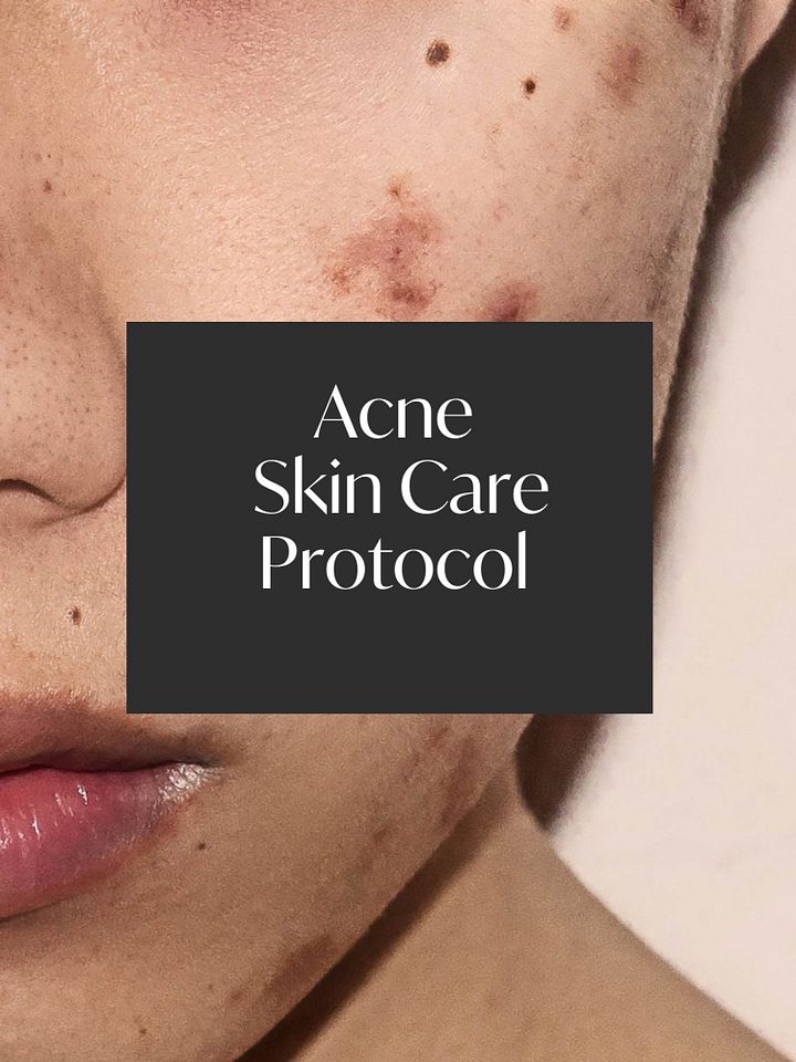 The Complete Acne Skincare Protocol product image (1)