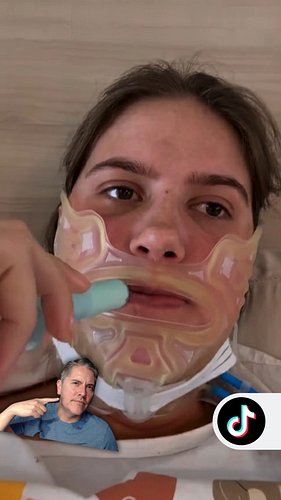 ¿Pensando en una cirugía de mandíbula?
Ya sea un procedimiento estético como el contorno mandibular o uno funcional como la c...