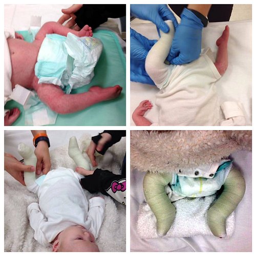 Most people look at serial casting and instantly see something negative. I understand why. If you have never needed it, it lo...