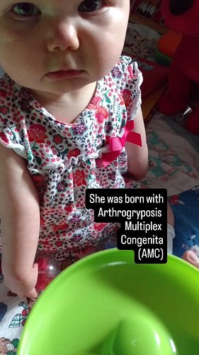 Her left arm hung by her side, unable to move, until she was about 7 months old! Every day, every movement, every task, every...
