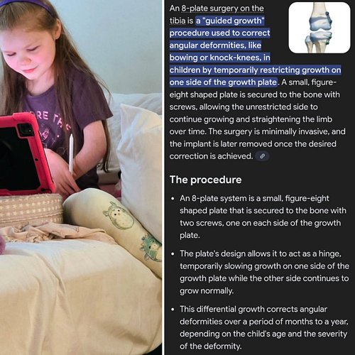 Just a “typical” school day for Ana… you know, if you ignore the part where she’s doing it all in casts. 😅 Homeroom, ASL, Spa...