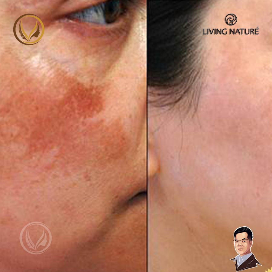 Dầu dưỡng sáng da, giảm sạm nám ban đêm Living Nature Radiance Night Oil 18ml product image (6)
