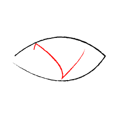 Im_Burnal