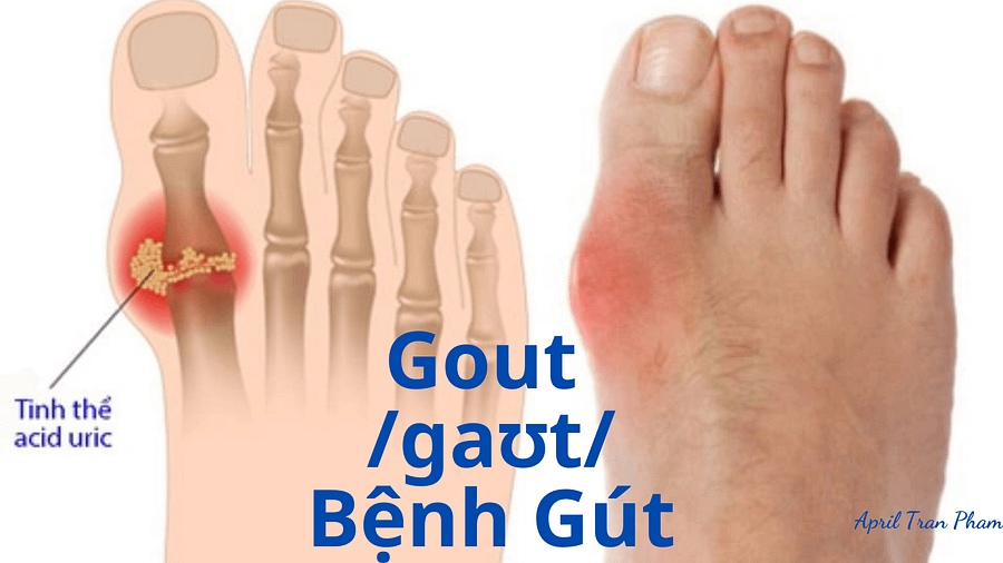 Vocabulary about diseases product image (2)