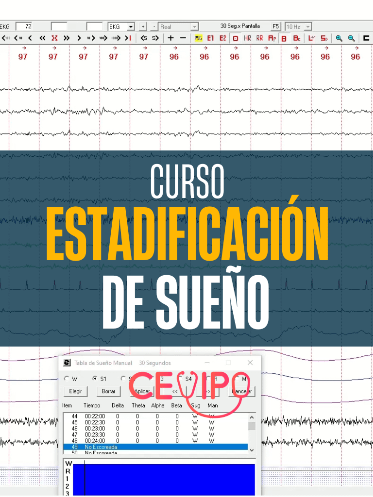 Curso Estadificación de Sueño product image (1)