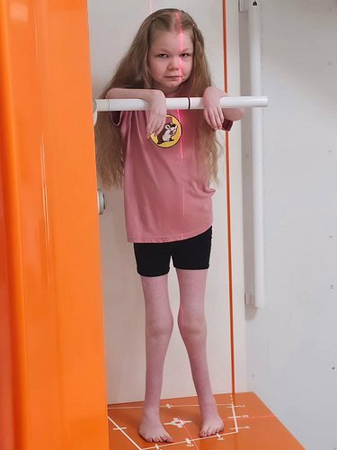 This is a photo of Ana getting her X-rays on Thursday. You can see a short video on the earlier post and I'll post a couple m...