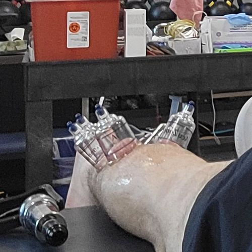 👈 Physical Therapy Updates

🍵 cupping
🪡 dry needles
🧊 cold boot
🩸 bloodflow restriction training

Taking advantage of every o...