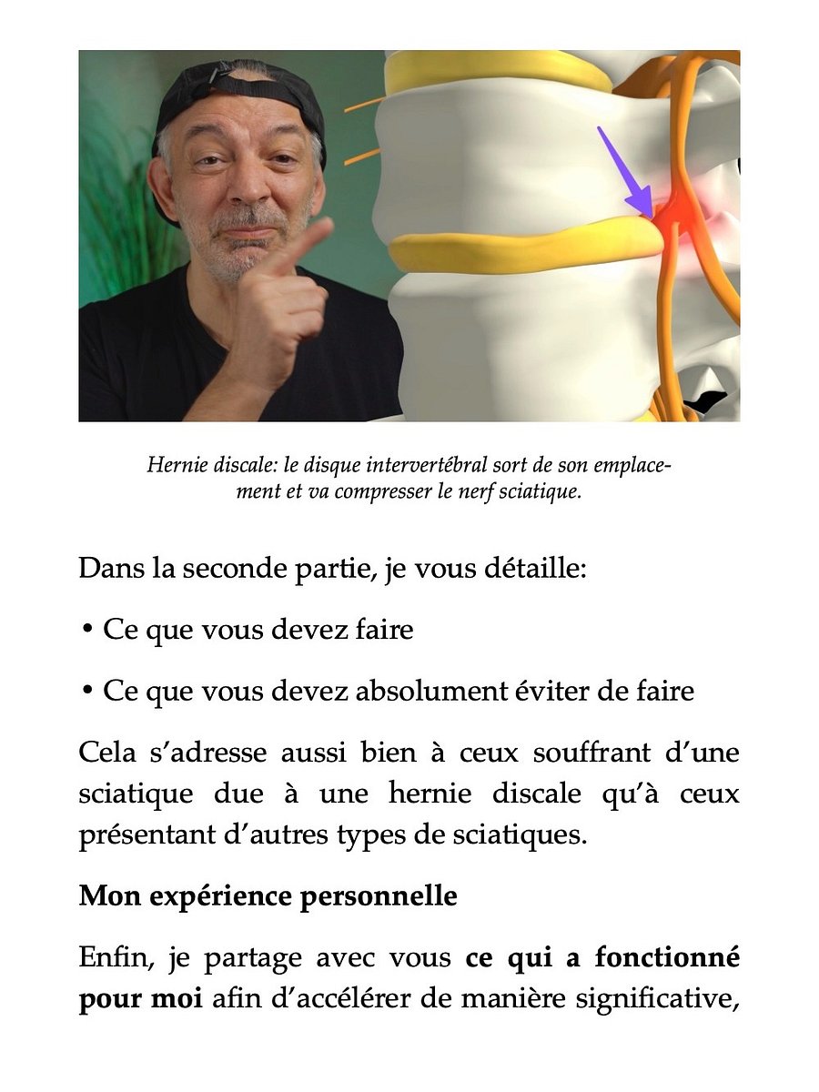La Sciatique par hernie discale - Comment j'en suis venu à bout product image (5)