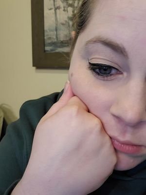 help I'm tired and my face is breaking out and I need a nap I am SO CONFUSED  #tiktokban #rednote #contentcreator #socialmedia 