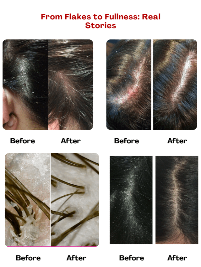 Follicare™ – The Innovative Solution for Healthy Hair & Scalp product image (7)