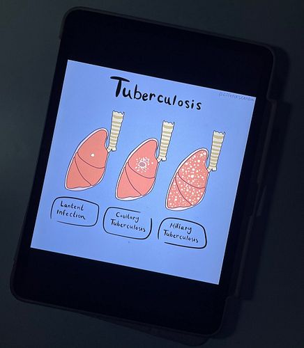 Tuberculosis | 🫁 
.
.
.

#medicine #pharmacy #pharmacology #anatomy #theskull #medstudent #pharmacystudent #medicalart #artof...